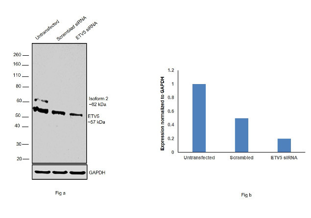 ETV5 Antibody