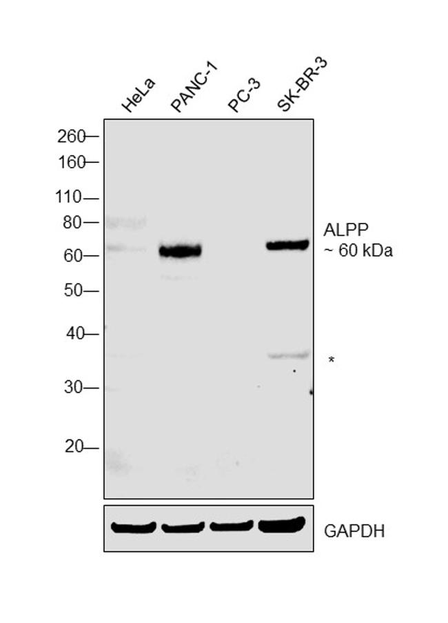 Placental Alkaline Phosphatase Antibody in Western Blot (WB)