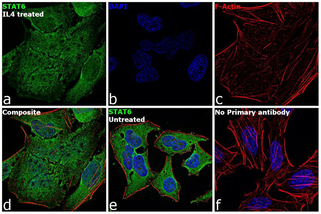 STAT6 Antibody in Immunocytochemistry (ICC/IF)