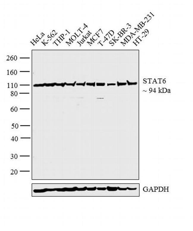 STAT6 Antibody in Western Blot (WB)