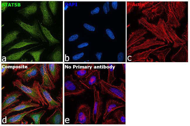 STAT5 beta Antibody in Immunocytochemistry (ICC/IF)