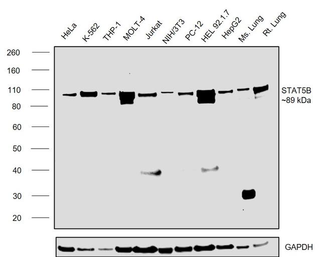 STAT5 beta Antibody in Western Blot (WB)