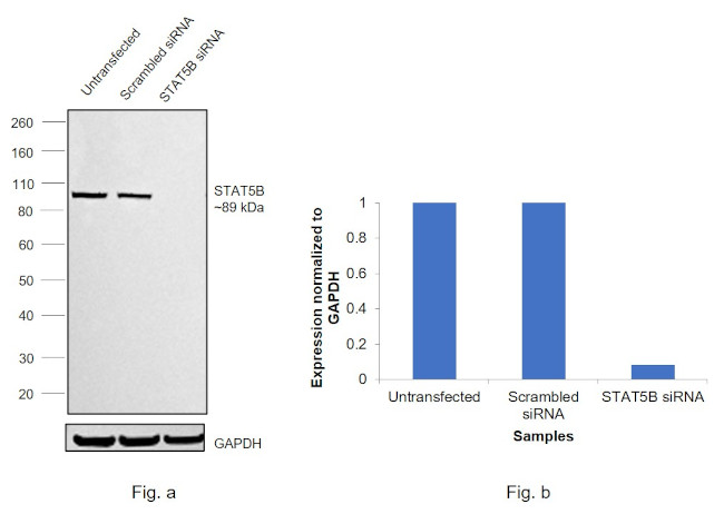 STAT5 beta Antibody