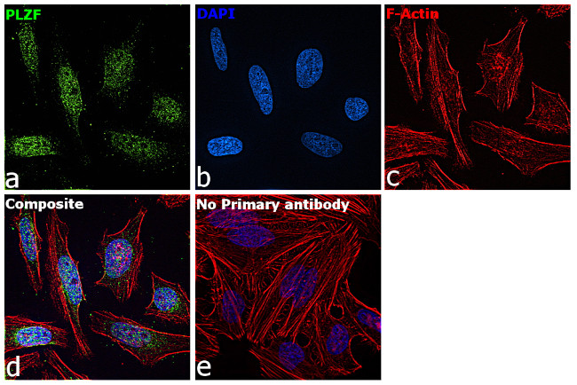 PLZF Antibody in Immunocytochemistry (ICC/IF)