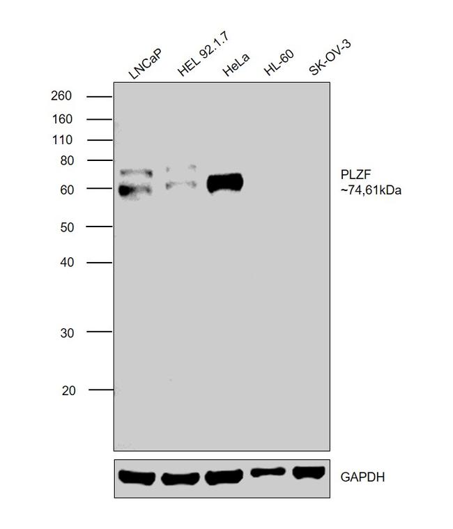 PLZF Antibody in Western Blot (WB)