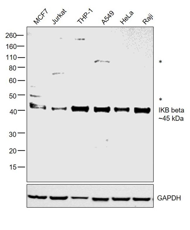 IkB beta Antibody in Western Blot (WB)