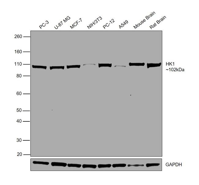 HK1 Antibody in Western Blot (WB)