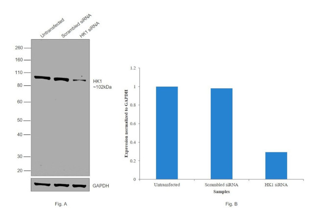 HK1 Antibody