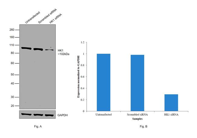 HK1 Antibody in Western Blot (WB)