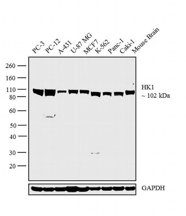 HK1 Antibody in Western Blot (WB)