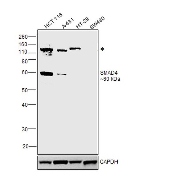 SMAD4 Antibody in Western Blot (WB)