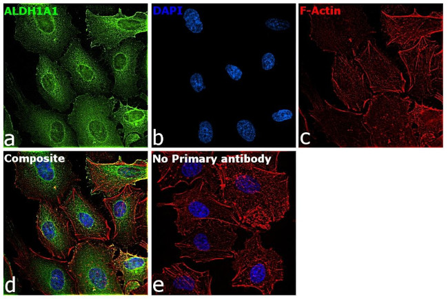 ALDH1A1 Antibody in Immunocytochemistry (ICC/IF)