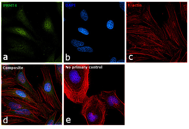 PRMT4 Antibody in Immunocytochemistry (ICC/IF)