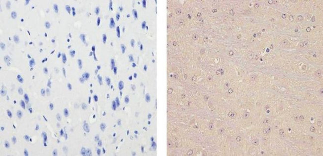 Glucocorticoid Receptor Antibody in Immunohistochemistry (Paraffin) (IHC (P))