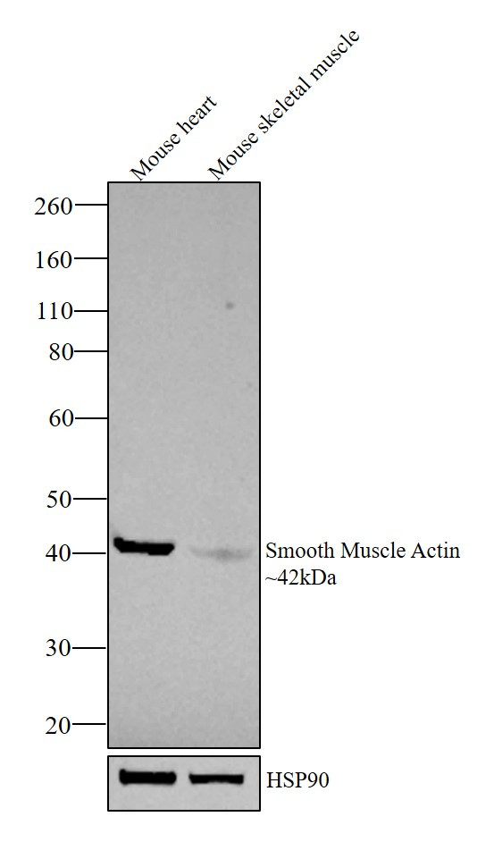 Alpha-Smooth Muscle Actin Antibody