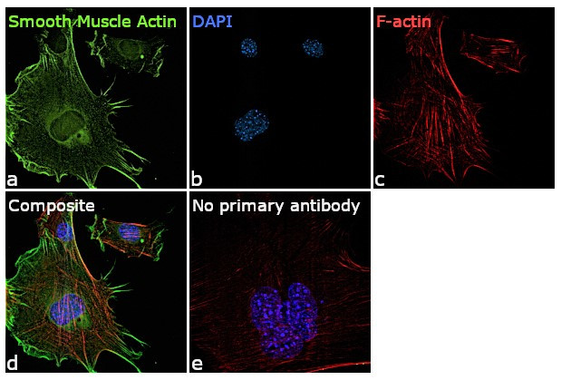 Alpha-Smooth Muscle Actin Antibody in Immunocytochemistry (ICC/IF)