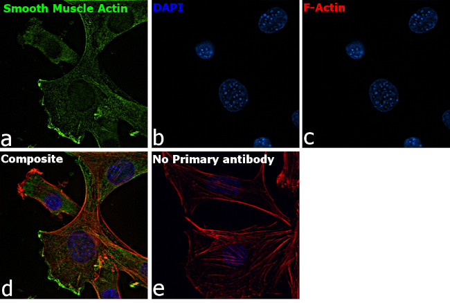 Alpha-Smooth Muscle Actin Antibody in Immunocytochemistry (ICC/IF)