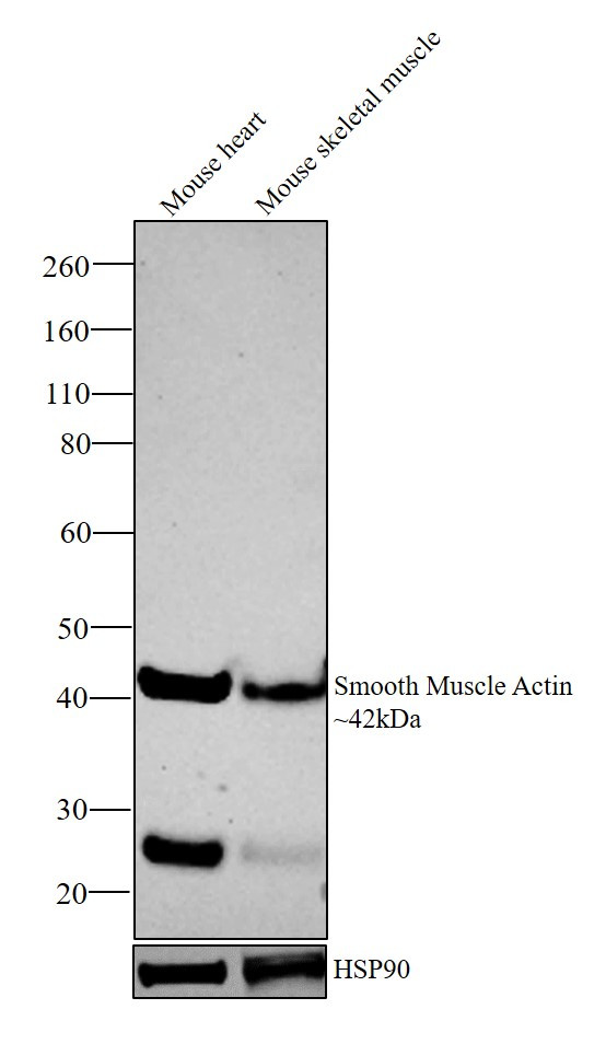 Alpha-Smooth Muscle Actin Antibody