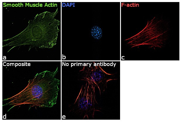 Alpha-Smooth Muscle Actin Antibody in Immunocytochemistry (ICC/IF)