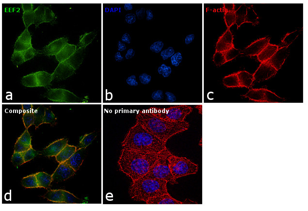 EEF2 Antibody in Immunocytochemistry (ICC/IF)