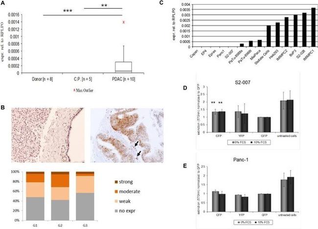 GRK2 Antibody in Immunohistochemistry (Paraffin) (IHC (P))