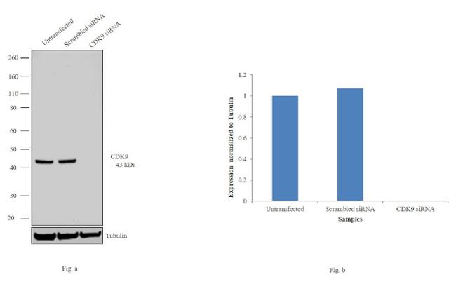 CDK9 Antibody in Western Blot (WB)