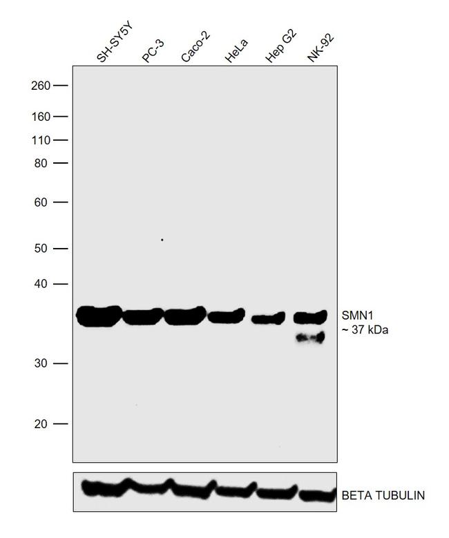 SMN1 Antibody in Western Blot (WB)