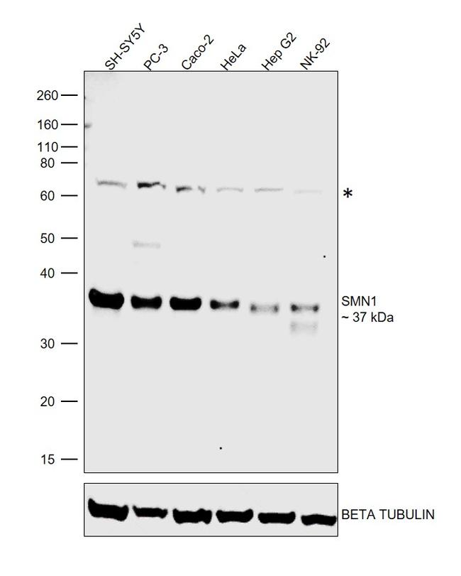 SMN1 Antibody in Western Blot (WB)