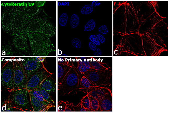 Cytokeratin 19 Antibody in Immunocytochemistry (ICC/IF)