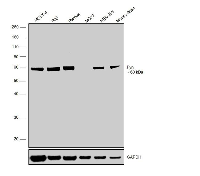 Fyn Antibody in Western Blot (WB)