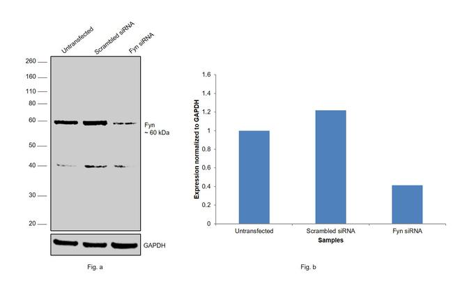 Fyn Antibody in Western Blot (WB)