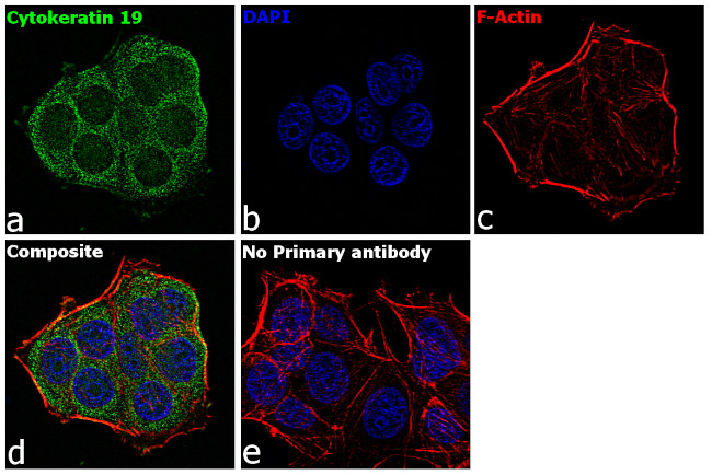 Cytokeratin 19 Antibody in Immunocytochemistry (ICC/IF)