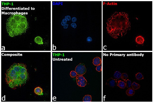 MMP9 Antibody