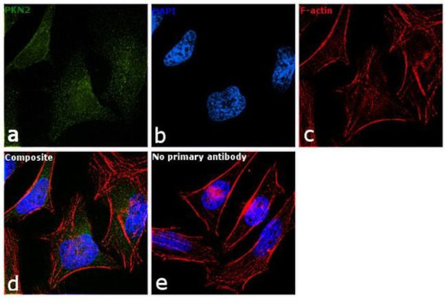 PKN2 Antibody in Immunocytochemistry (ICC/IF)