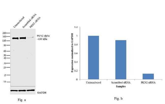 PKN2 Antibody in Western Blot (WB)