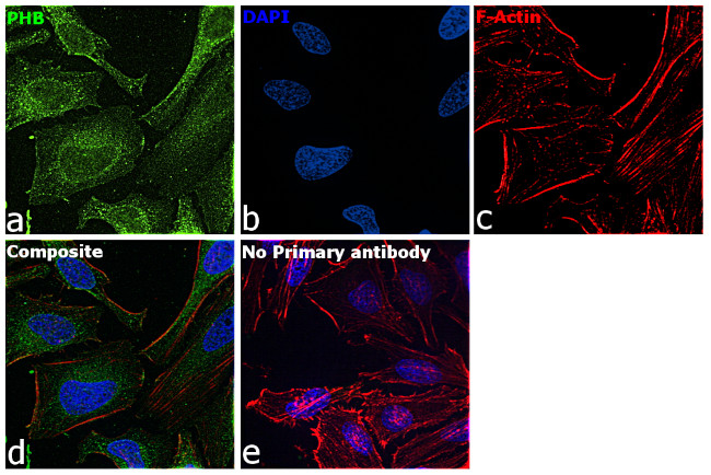 Prohibitin Antibody in Immunocytochemistry (ICC/IF)