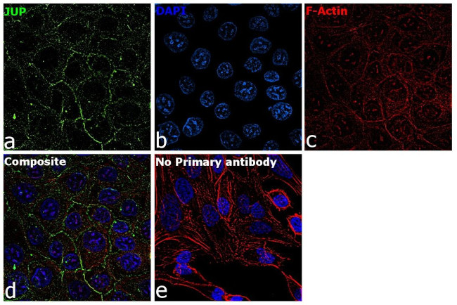 gamma Catenin Antibody in Immunocytochemistry (ICC/IF)