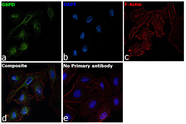 G6PD Antibody in Immunocytochemistry (ICC/IF)