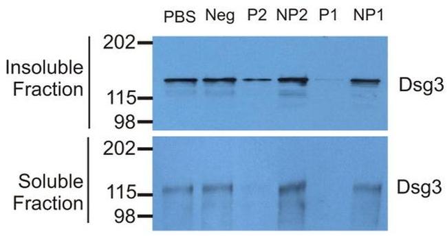 Desmoglein 3 Antibody in Western Blot (WB)