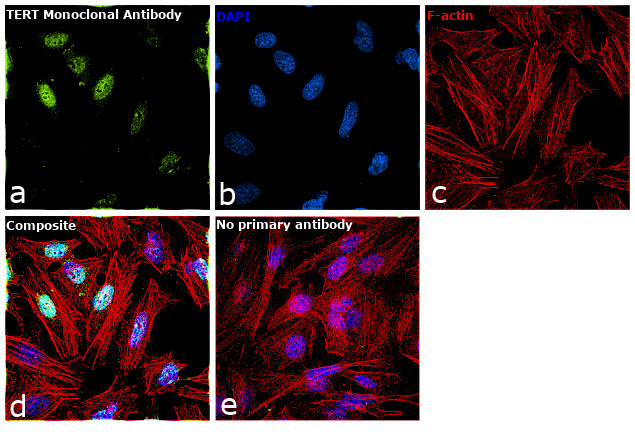 TERT Antibody in Immunocytochemistry (ICC/IF)