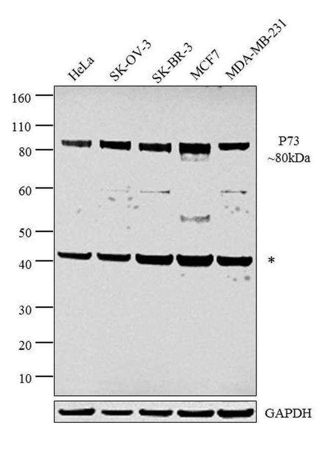 p73 Antibody in Western Blot (WB)