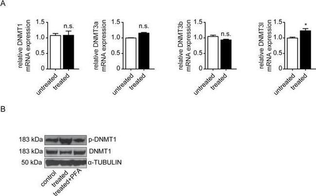 DNMT1 Antibody in Western Blot (WB)