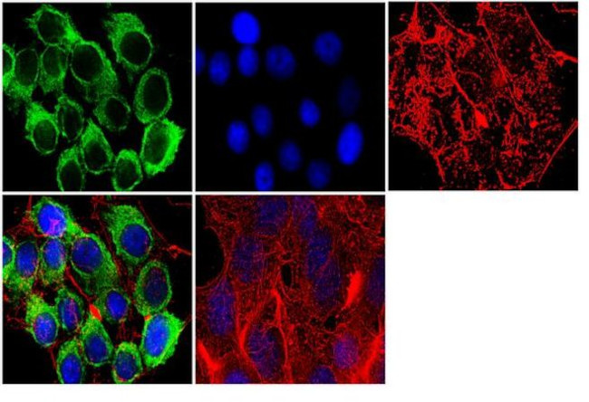 Dnmt2 Antibody in Immunocytochemistry (ICC/IF)