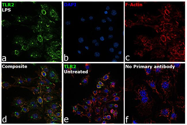 TLR2 Antibody