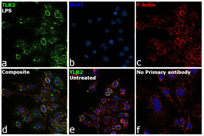 TLR2 Antibody in Immunocytochemistry (ICC/IF)