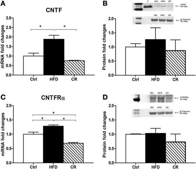 beta Tubulin Loading Control Antibody in Western Blot (WB)