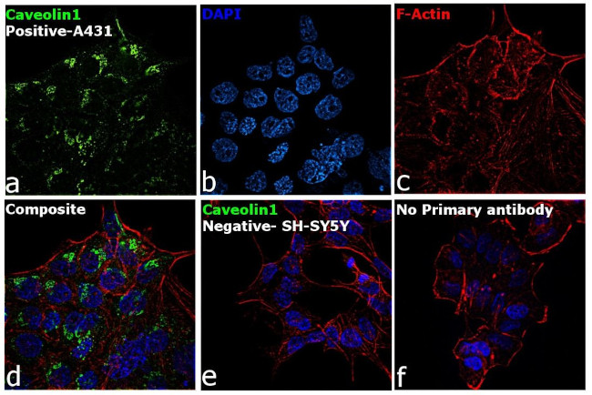 Caveolin 1 Antibody