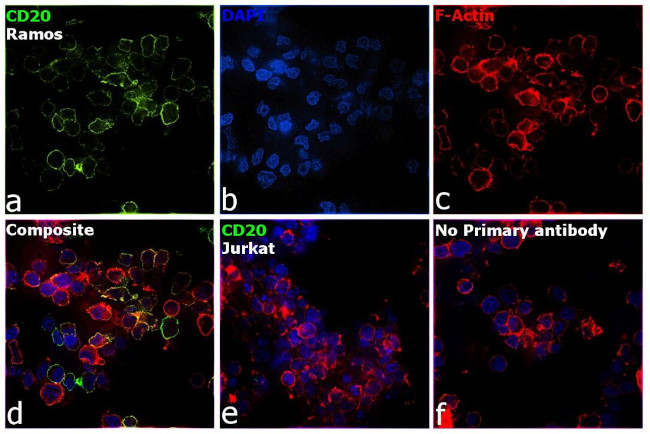 CD20 Antibody in Immunocytochemistry (ICC/IF)