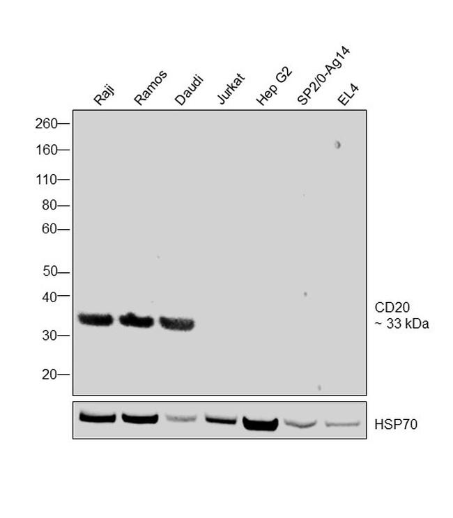 CD20 Antibody in Western Blot (WB)