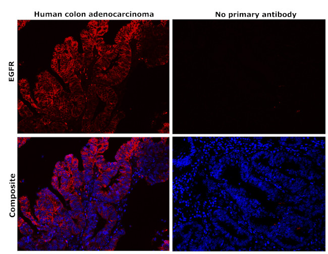 EGFR Antibody in Immunohistochemistry (Paraffin) (IHC (P))